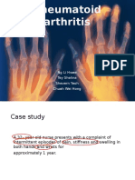 Rheumatoid Arthritis