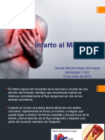 Infarto Del Miocardio