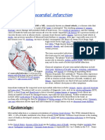 Myocardial Infarction