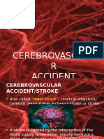 Cerebrovascula R Accident