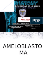 Ameloblastoma