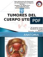 Tumores Uterinos