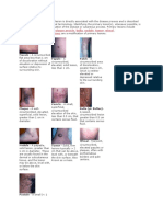 Skin Lesion