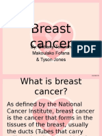 Breast Cancer Epidemiology