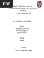 Topografía Corneal