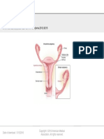 From: Ectopic Pregnancy: JAMA. 2012 308 (8) :829-829. Doi:10.1001/jama.2012.6215