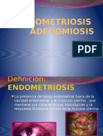 2 - Endometriosis