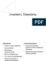 Inverted L Osteotomy