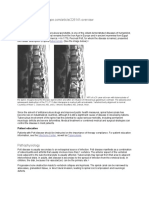 Pott's Disease Medscape