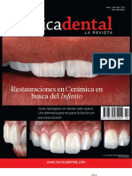 Alta Tecnica Dental - Restauraciones en Ceramica