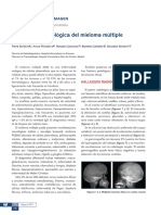 Semiologia Radiologica Mieloma Multiple PDF