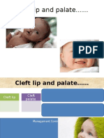 Cleft Lip and Palate