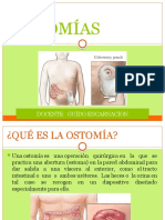 OSTOMIAS