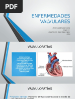 Enfermedades Valvulares