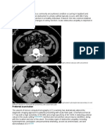 Preferred Examination: Right Ureteral Calculus With Periureteral Stranding