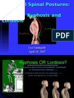 Abnormal Spinal Postures Kyphosis and Lordosis4352