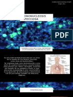 Mononucleosis Infecciosa