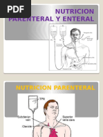 Nutrcion Enteral y Parenteral