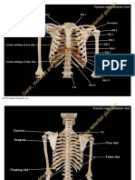 Pictures: Clavicle Rib 1