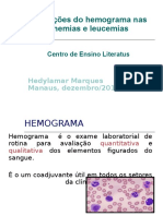 2 - Alterações Do Hemog Anemias e Leucemias