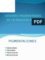 Lesiones Pigmentadas de La Mucosa Bucal 