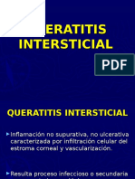 Queratitis Intersticial (HFNSL)