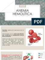 Anemia Hemolítica