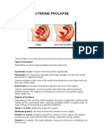 Uterine Prolapse