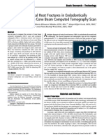 CBCT Detection of Vertical Root Fractures JOE 2009