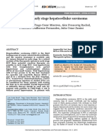 Surgery For Early Stage Hepatocellular Carcinoma