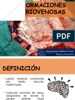 Malformaciones Arteriovenosas