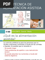 Técnica de Alimentación Asistida