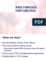 Uterine Fibroids