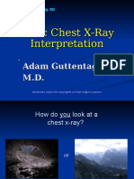 Basis Chest X-Ray