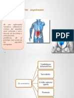 Espondilo Artritis