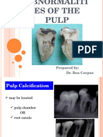 Abnormalities of The Pulp