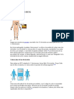 Derivaciones Del ECG