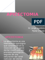 Apicectomia