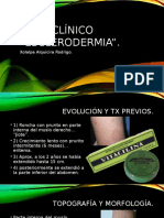 Caso Clínico de "Esclerodermia"