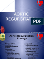 Aortic Regurgitation