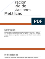 Diseño de La Cavidad en Incrustaciones Metalicas