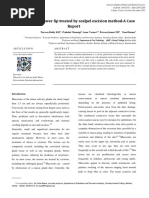 Mucocele On The Lower Lip Treated by Scalpel Excision Method-A Case