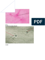 Knitted Fabric Defects