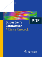 Dupuytren's Contracture