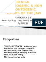 Odontogenik Tumor Jinak