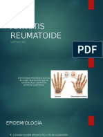 Artritis Osteoartritis Artritis Gotosa