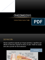 Onicomicosis