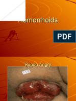 Hemorrhoids 2