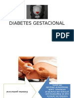 Diabetes Gestacional