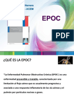 Epoc - Ges